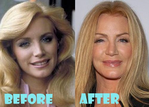 Shannon Tweed Shoe Size and Body Measurements